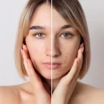 Qual o papel do profissional na harmonização facial