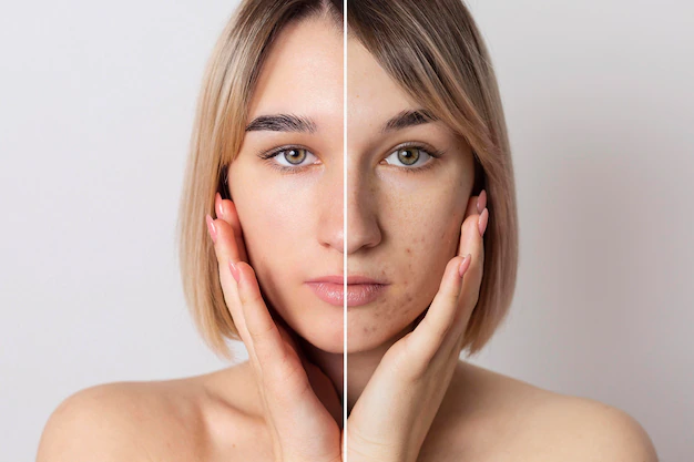Qual o papel do profissional na harmonização facial