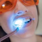 Cuidados e recomendações pós-clareamento dental