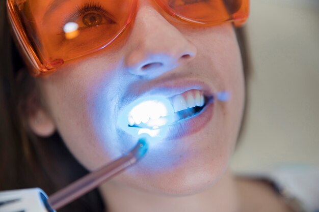 Cuidados e recomendações pós-clareamento dental